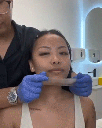 PHS Active DermaClinic Shrink Vline Lifting Shaper